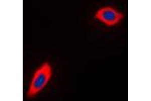 Immunofluorescent analysis of PEX11B staining in THP1 cells. (PEX11B Antikörper  (Center))
