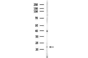 anti-RAB31, Member RAS Oncogene Family (RAB31) (Internal Region) antibody