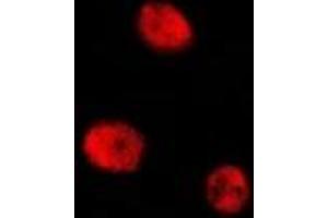 Immunofluorescent analysis of CREB (pS129) staining in RAW264. (CREB1 Antikörper  (pSer129))