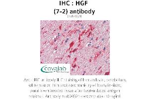 Image no. 1 for anti-Hepatocyte Growth Factor (Hepapoietin A, Scatter Factor) (HGF) antibody (ABIN1723243)