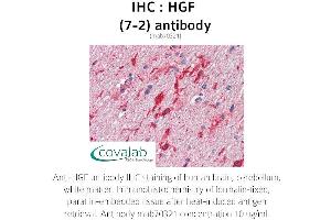 Image no. 1 for anti-Hepatocyte Growth Factor (Hepapoietin A, Scatter Factor) (HGF) antibody (ABIN1723243) (HGF Antikörper)