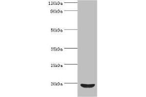 Western blot All lanes: Low molecular weight phosphotyrosine protein phosphatase antibody at 4 μg/mL + HepG2 whole cell lysate Secondary Goat polyclonal to rabbit IgG at 1/10000 dilution Predicted band size: 19, 18, 15, 13 kDa Observed band size: 19 kDa (ACP1 Antikörper  (AA 1-158))