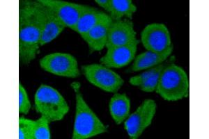 Immunofluorescence analysis of MCF-7 cells using PRKCA antibody (ABIN5997085). (PKC alpha Antikörper)