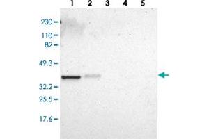 Western blot analysis of Lane 1: RT-4, Lane 2: U-251 MG, Lane 3: Human Plasma, Lane 4: Liver, Lane 5: Tonsil with ARPC1A polyclonal antibody  at 1:250-1:500 dilution. (ARPC1A Antikörper)