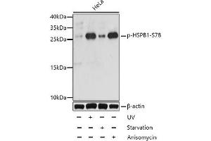 Western blot analysis of extracts of HeLa cells using Phospho-HSPB1(S78) Polyclonal Antibody at dilution of 1:1000. (HSP27 Antikörper  (pSer78))
