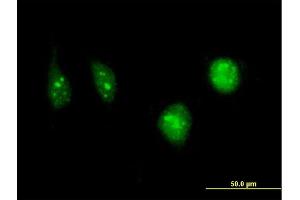 Immunofluorescence of monoclonal antibody to DCK on HeLa cell.