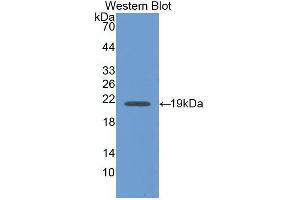 Western blot analysis of the recombinant protein. (Interferon gamma Antikörper  (AA 24-167))