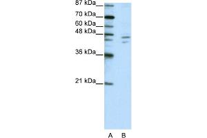 WB Suggested Anti-ZNF419A Antibody Titration:  2. (ZNF419 Antikörper  (C-Term))