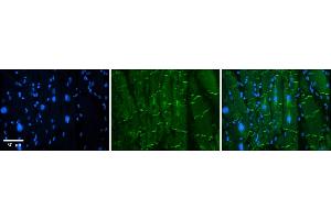 Rabbit Anti-AMOT Antibody    Formalin Fixed Paraffin Embedded Tissue: Human Adult heart  Observed Staining: Membrane(tight junctions - intercalated disks) Primary Antibody Concentration: 1:600 Secondary Antibody: Donkey anti-Rabbit-Cy2/3 Secondary Antibody Concentration: 1:200 Magnification: 20X Exposure Time: 0. (Angiomotin Antikörper  (N-Term))