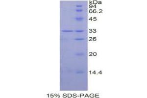 SDS-PAGE analysis of Human STAT6 Protein. (STAT6 Protein)