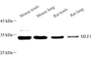 Western blot analysis of MLF1 (ABIN7074712) at dilution of 1: 500 (MLF1 Antikörper)