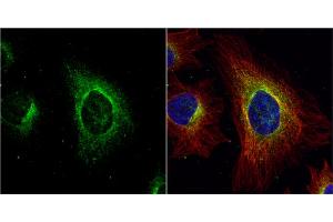 ICC/IF Image ASL antibody detects ASL protein at cytoplasm by immunofluorescent analysis.