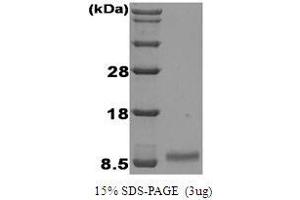 Figure annotation denotes ug of protein loaded and % gel used. (IGF1 Protein (AA 1-115))