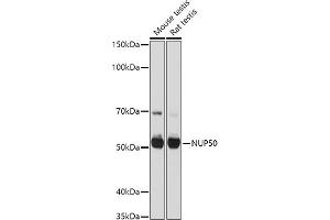 Western blot analysis of extracts of various cell lines, using NUP50 antibody (ABIN6128364, ABIN6144963, ABIN6144964 and ABIN6225005) at 1:1000 dilution. (NUP50 Antikörper  (AA 299-468))