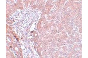 Immunohistochemical staining of rat liver tissue with NDUFB9 polyclonal antibody  at 5 ug/mL dilution.