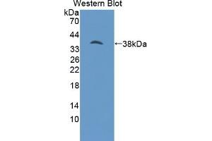 Detection of Recombinant PSAT1, Human using Polyclonal Antibody to Phosphoserine Aminotransferase 1 (PSAT1) (PSAT1 Antikörper  (AA 1-312))