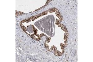 Immunohistochemical staining of human prostate with TPCN2 polyclonal antibody  shows strong membranous positivity in glandular cells. (TPCN2 Antikörper)