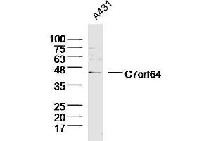 Lane 1: A431 lysates probed with C7orf64 Polyclonal Antibody, Unconjugated  at 1:300 overnight at 4˚C. (C7orf64 Antikörper  (AA 1-100))