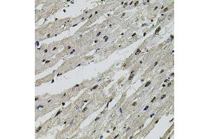 Immunohistochemistry of paraffin-embedded rat heart using CTNNB1 antibody (ABIN4903403) at dilution of 1:100 (40x lens). (CTNNB1 Antikörper)