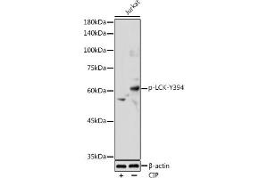 Western blot analysis of extracts of Jurkat cells, using Phospho-LCK-Y394 antibody (ABIN3019739, ABIN3019740, ABIN3019741 and ABIN7101863) at 1:1000 dilution. (LCK Antikörper  (pTyr394))