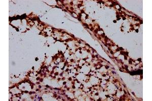 IHC image of ABIN7170858 diluted at 1:400 and staining in paraffin-embedded human testis tissue performed on a Leica BondTM system. (SMC1B Antikörper  (AA 954-1060))