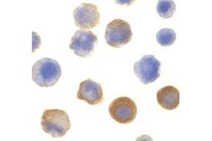Immunocytochemistry of IRAK in HeLa cells with AP30438PU-N IRAK antibody at 10 μg/ml. (IRAK1 Antikörper  (C-Term))