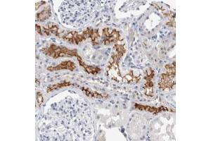 Immunohistochemical staining (Formalin-fixed paraffin-embedded sections) of human kidney with SLC22A12 polyclonal antibody  shows strong membranous positivity in cells in tubules. (SLC22A12 Antikörper)