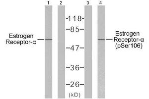 Western blot analysis of extracts from MCF7 cells, using Estrogen Receptor-α (Ab-106) antibody (E021066) and Estrogen Receptor-α (phospho-Ser106) antibody (E011071). (Estrogen Receptor alpha Antikörper  (pSer106))