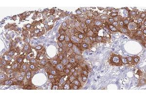 Immunohistochemistry (IHC) image for anti-Interleukin 11 Receptor, alpha (IL11RA) (C-Term) antibody (ABIN6257607)