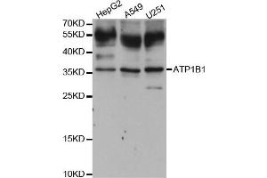 Western blot analysis of extracts of various cell lines, using ATP1B1 antibody. (ATP1B1 Antikörper)