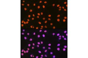 Immunofluorescence analysis of HeLa cells using SMC1 Rabbit mAb (ABIN7270614) at dilution of 1:100 (40x lens). (SMC1A Antikörper)