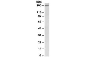 Western blot testing of human albumin-depleted serum lysate with alpha-2-macroglobulin antibody at 0. (alpha 2 Macroglobulin Antikörper)