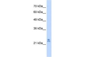 Western Blotting (WB) image for anti-Mitochondrial Ribosomal Protein S15 (MRPS15) antibody (ABIN2461942) (MRPS15 Antikörper)
