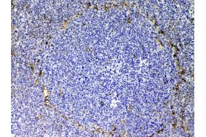 Immunohistochemistry (IHC) image for anti-Endoglin (ENG) (AA 27-226) antibody (ABIN5518982)