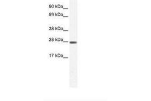 Image no. 1 for anti-Chloride Intracellular Channel 1 (CLIC1) (C-Term) antibody (ABIN6735458) (CLIC1 Antikörper  (C-Term))