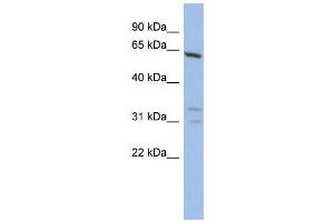 WB Suggested Anti-GTF2F1  Antibody Titration: 0. (GTF2F1 Antikörper  (N-Term))