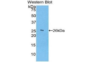 Western Blotting (WB) image for anti-Ficolin (Collagen/fibrinogen Domain Containing) 1 (FCN1) (AA 45-249) antibody (ABIN3207866) (FCN1 Antikörper  (AA 45-249))