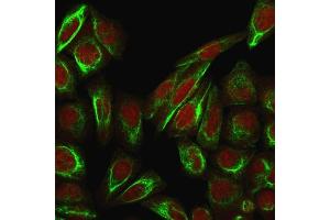 Immunofluorescence (IF) image for anti-Collagen, Type VII, alpha 1 (COL7A1) antibody (ABIN6939168)