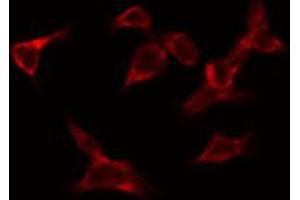 ABIN6269212 staining HeLa by IF/ICC. (CDC25A Antikörper  (N-Term))
