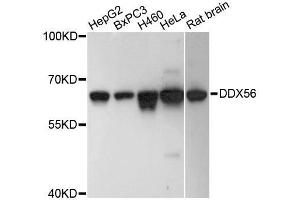 Western blot analysis of extracts of various cell lines, using DDX56 antibody. (DDX56 Antikörper  (AA 318-547))