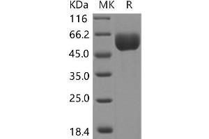 Western Blotting (WB) image for Sphingomyelin phosphodiesterase, Acid-Like 3A (SMPDL3A) protein (His tag) (ABIN7320020)