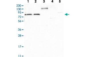 Western blot analysis of Lane 1: RT-4, Lane 2: U-251 MG, Lane 3: Human Plasma, Lane 4: Liver, Lane 5: Tonsil with TBC1D30 polyclonal antibody  at 1:100-1:250 dilution.