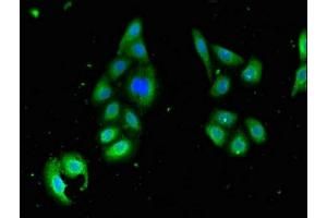 Immunofluorescent analysis of HepG2 cells using ABIN7168997 at dilution of 1:100 and Alexa Fluor 488-congugated AffiniPure Goat Anti-Rabbit IgG(H+L) (STK35 Antikörper  (AA 1-200))