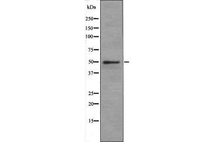 SLC1A5 antibody at 1 µg/ml + Jurkat (Human T cell lymphoblast-like cell line) Whole Cell Lysate. (SLC1A5 Antikörper  (Internal Region))