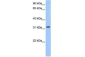 C14ORF140 antibody used at 1 ug/ml to detect target protein. (ZC2HC1C Antikörper  (N-Term))