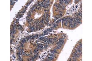 Immunohistochemistry (IHC) image for anti-Nuclear Factor of Activated T-Cells, Cytoplasmic, Calcineurin-Dependent 3 (NFATC3) antibody (ABIN2421909) (NFATC3 Antikörper)