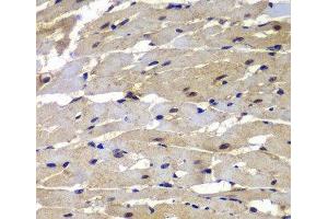 Immunohistochemistry of paraffin-embedded Rat heart using PSMB8 Polyclonal Antibody at dilution of 1:100 (40x lens).