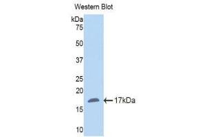 Western Blotting (WB) image for anti-Nicotinamide N-Methyltransferase (NNMT) (AA 127-249) antibody (ABIN1860014) (NNMT Antikörper  (AA 127-249))