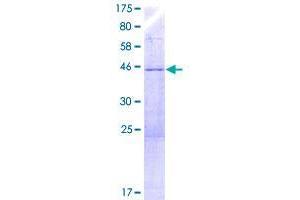 YPEL3 Protein (AA 1-201) (GST tag)