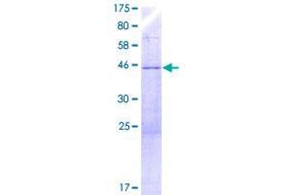 YPEL3 Protein (AA 1-201) (GST tag)